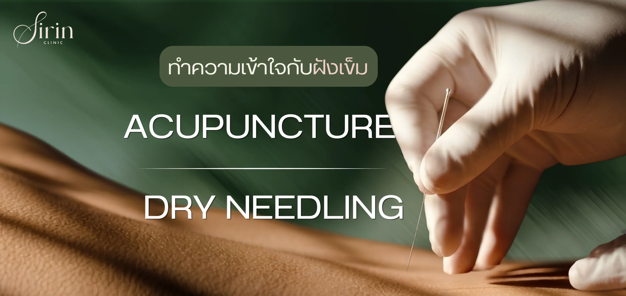 ทำความเข้าใจ Acupuncture VS Dry Needling