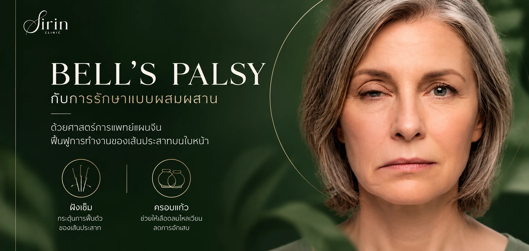 Bell’s Palsy: เมื่อใบหน้าอ่อนแรง การรักษาแบบผสมผสานช่วยดูแลได้อย่างไร?